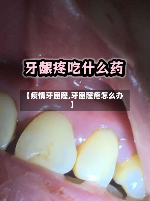 【疫情牙窟窿,牙窟窿疼怎么办】